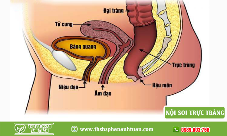 Nội soi trực tràng