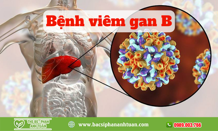 Bệnh viêm gan B