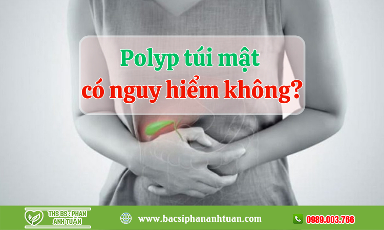 Polyp túi mật có nguy hiểm không?